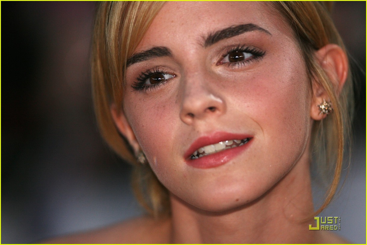 emma watson teeth