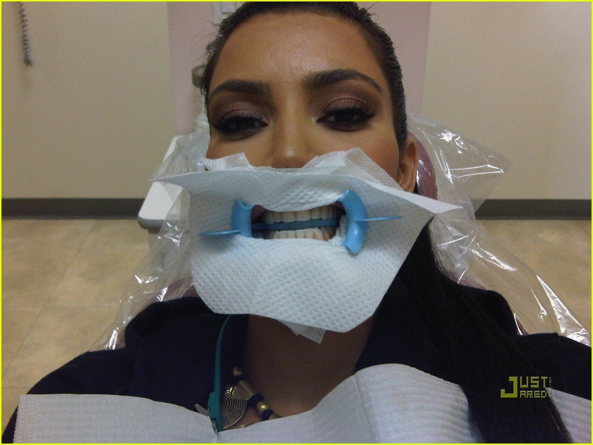 Kim Kardashian Dentist Difference Photo 2401349 Kim Kardashian