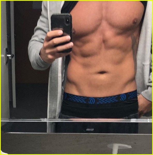 Jersey Shore's Ronnie OrtizMagro Gets Liposuction on His Abs to Keep