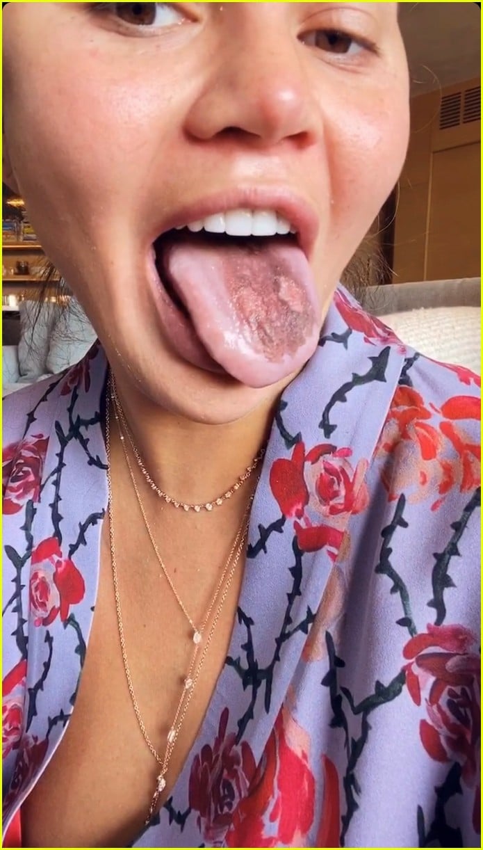 Chrissy Teigen Says Her 'Tongue Is Falling Off' from Eating 'So Much