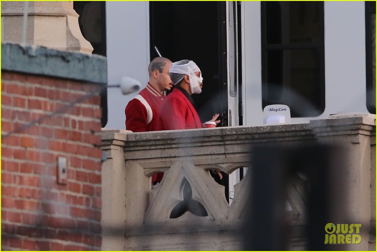 The Weeknd S Head Is Covered With Bandages While Filming New Music Video In L A Photo 4499626 The Weeknd Pictures Just Jared