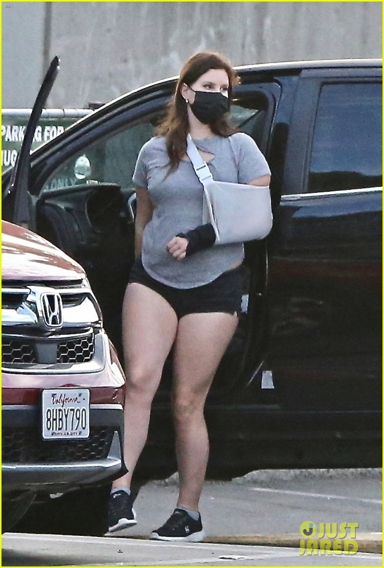 Lana Del Rey Puts Her Arm in Sling for PostChristmas