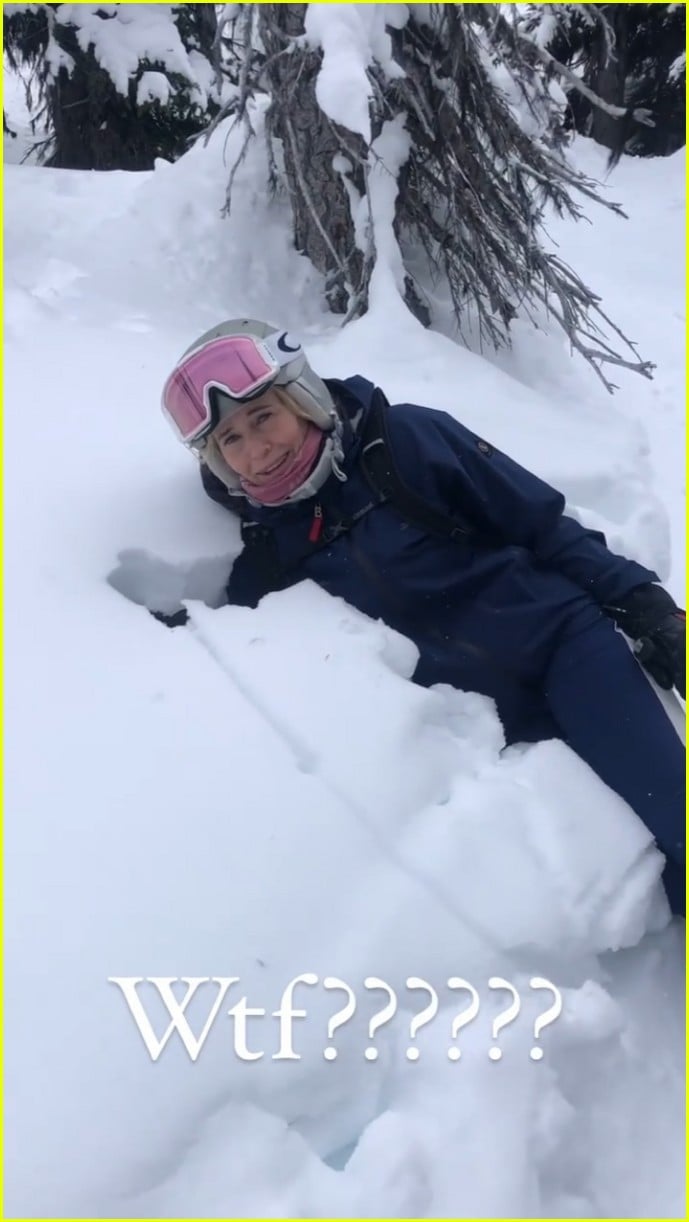 Chelsea Handler Suffers Torn Meniscus & Broken Toes From Skiing Photo